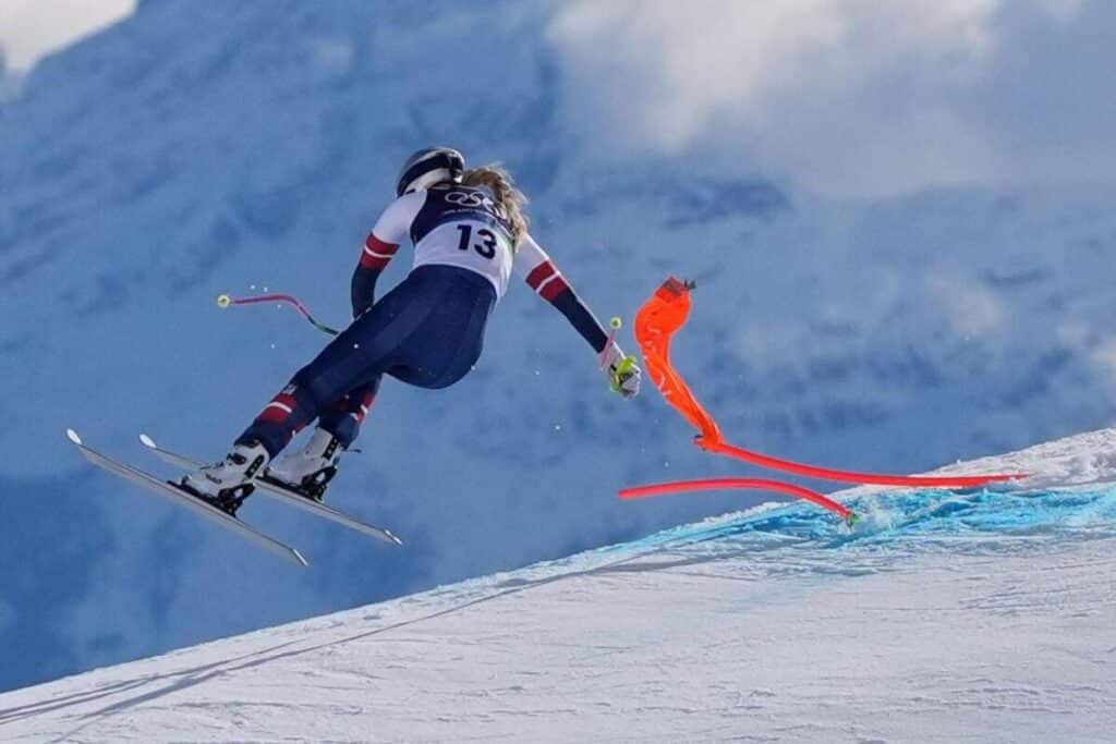 Vonn could have lost leg in Olympic accident