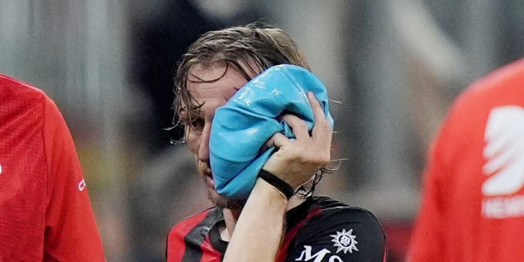 AC Milan: Modric set for surgery on facial injury